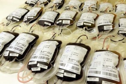Ma purpurovu farbu a dlh trvanlivost Japonski vedci vytvorili umelu krv
