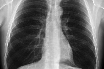 Nikto nevie komu umela inteligencia vezme pracu