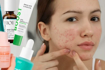 Je kyselina azelaová bezpečná pre citlivú pleť a pomôže pri akné? Otázky a odpovede