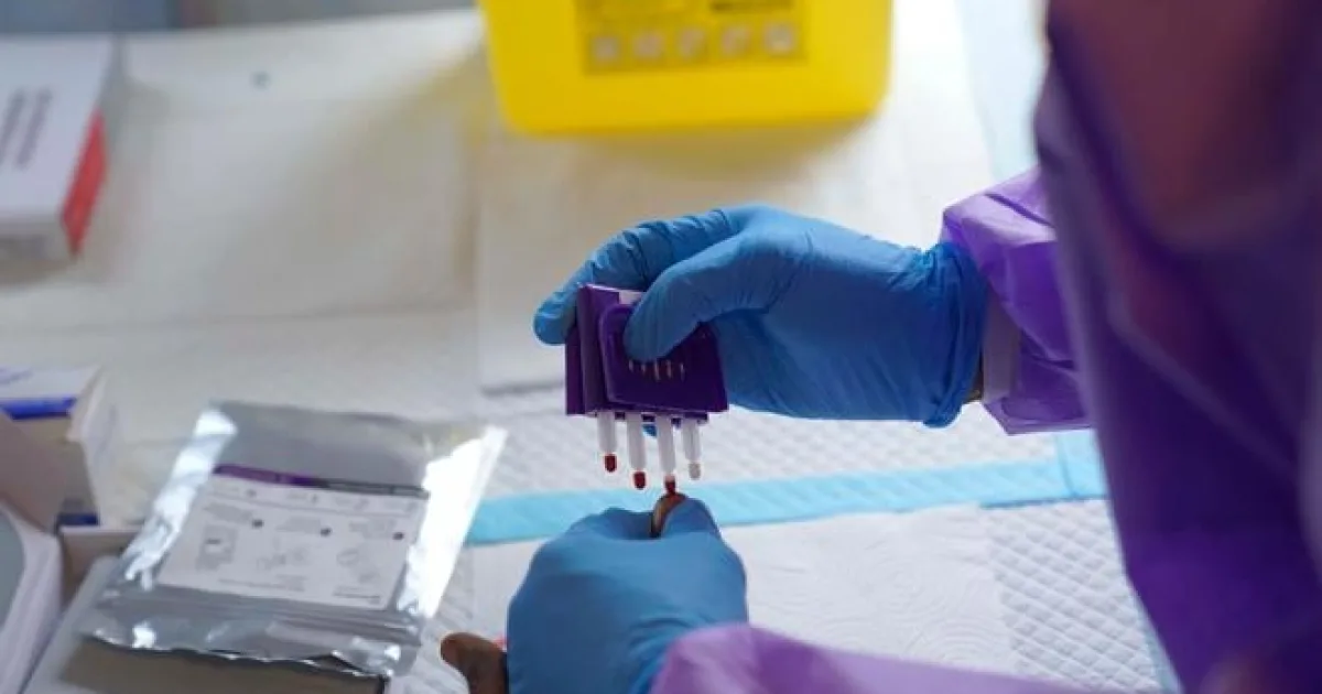 V Keni druhé úmrtie na ebolu, v KDR už testujú vakcínu